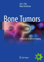Bone Tumors