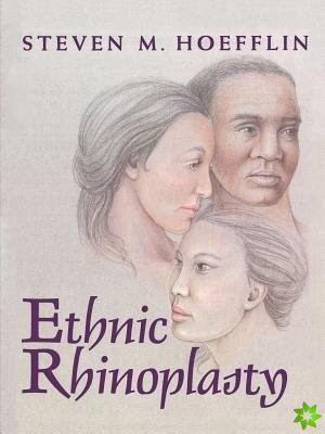 Ethnic Rhinoplasty