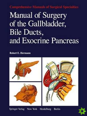Manual of Surgery of the Gallbladder, Bile Ducts, and Exocrine Pancreas