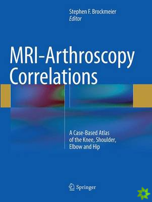 MRI-Arthroscopy Correlations