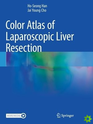 Color Atlas of Laparoscopic Liver Resection