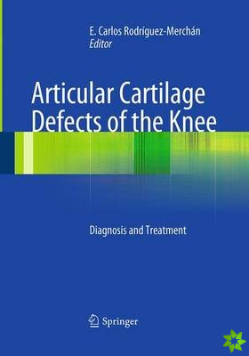 Articular Cartilage Defects of the Knee