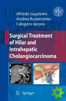 Surgical Treatment of Hilar and Intrahepatic Cholangiocarcinoma