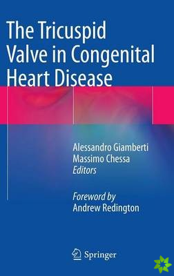 Tricuspid Valve in Congenital Heart Disease