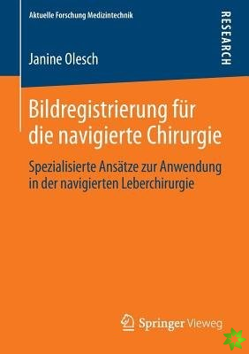 Bildregistrierung Fur Die Navigierte Chirurgie