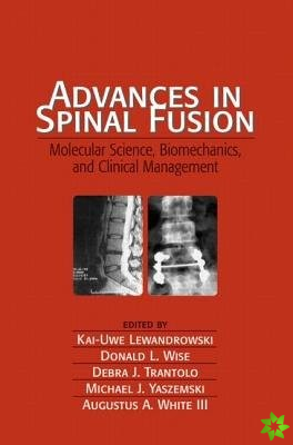 Advances in Spinal Fusion