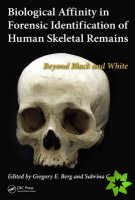 Biological Affinity in Forensic Identification of Human Skeletal Remains