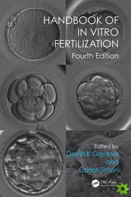 Handbook of In Vitro Fertilization