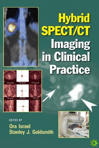 Hybrid SPECT/CT Imaging in Clinical Practice