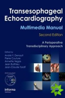 Transesophageal Echocardiography Multimedia Manual