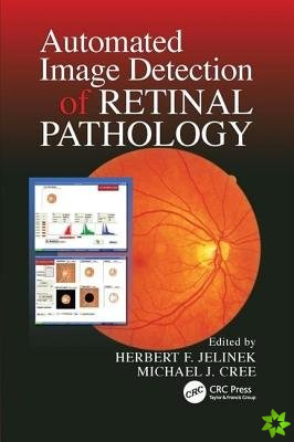 Automated Image Detection of Retinal Pathology
