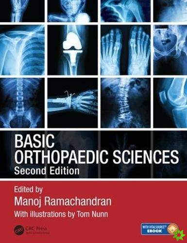 Basic Orthopaedic Sciences