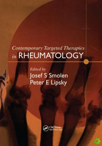 Contemporary Targeted Therapies in Rheumatology