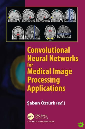 Convolutional Neural Networks for Medical Image Processing Applications