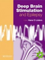 Deep Brain Stimulation and Epilepsy
