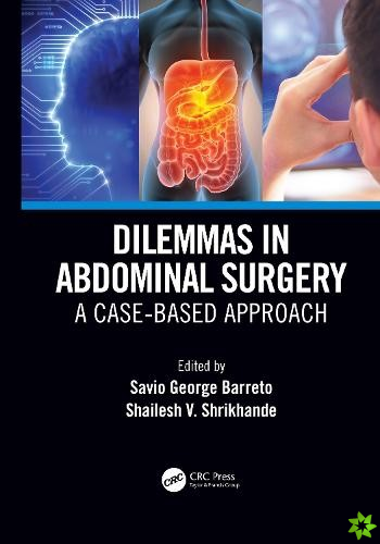 Dilemmas in Abdominal Surgery