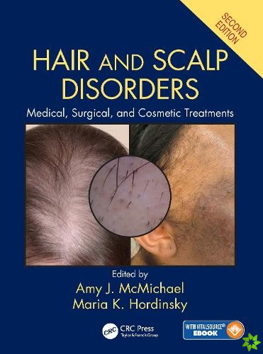Hair and Scalp Disorders