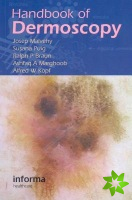 Handbook of Dermoscopy