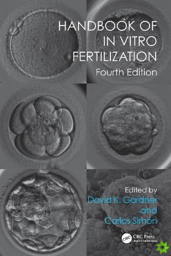 Handbook of In Vitro Fertilization