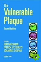 Handbook of the Vulnerable Plaque