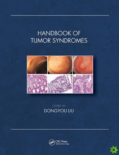 Handbook of Tumor Syndromes