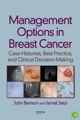 Management Options in Breast Cancer