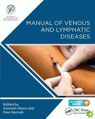 Manual of Venous and Lymphatic Diseases
