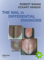 Nail in Differential Diagnosis