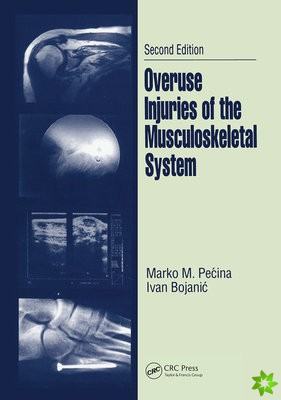 Overuse Injuries of the Musculoskeletal System