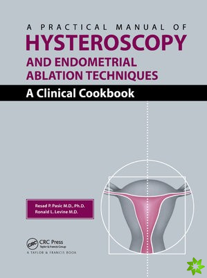 Practical Manual of Hysteroscopy and Endometrial Ablation Techniques