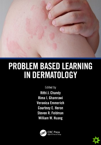 Problem Based Learning in Dermatology
