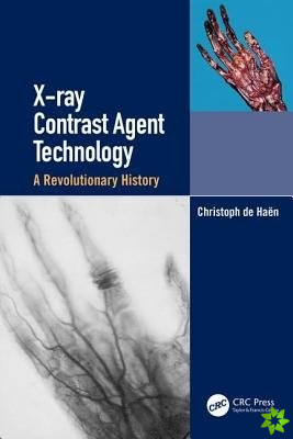 X-ray Contrast Agent Technology