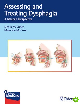 Assessing and Treating Dysphagia