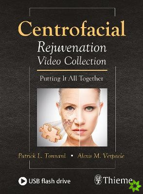 Centrofacial Rejuvenation Video Collection