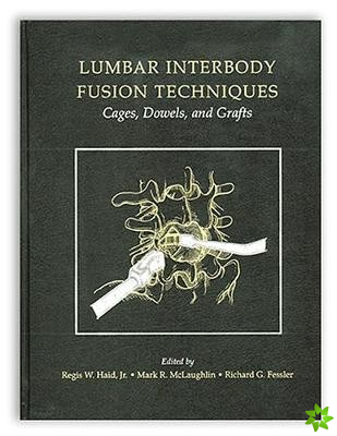 Lumbar Interbody Fusion Techniques: Cages, Dowels, and Grafts