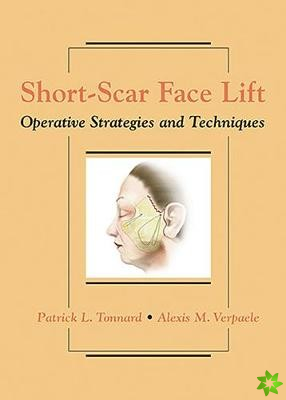 Short-Scar Face Lift