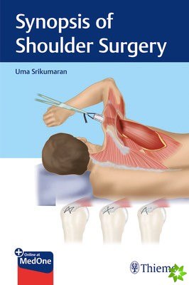 Synopsis of Shoulder Surgery