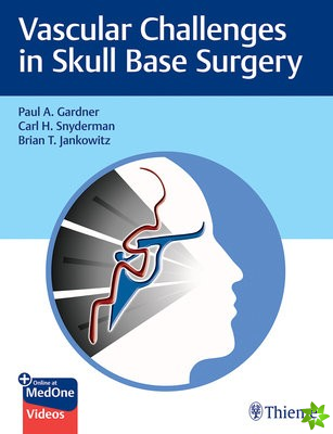 Vascular Challenges in Skull Base Surgery