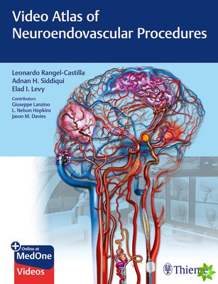 Video Atlas of Neuroendovascular Procedures