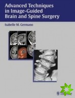 Advanced Techniques in Image-guided Brain and Spine Surgery