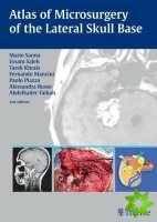 Atlas of Microsurgery of the Lateral Skull Base