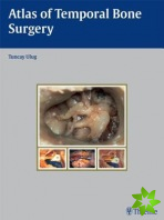 Atlas of Temporal Bone Surgery