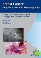 Casting-Type Calcifications: Sign of a Subtype with Deceptive Features