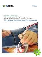 Minimally Invasive Spine Surgery - Techniques, Evidence, and Controversies