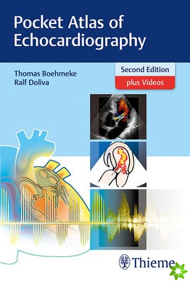 Pocket Atlas of Echocardiography