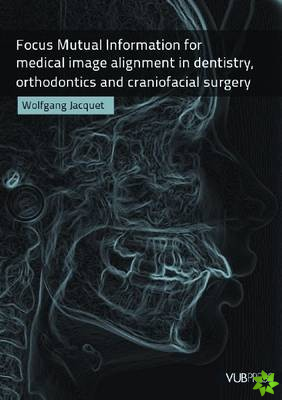Focus Mutual Information for Medical Image Alignment in Dentistry, Orthodontics and Craniofacial Surgery