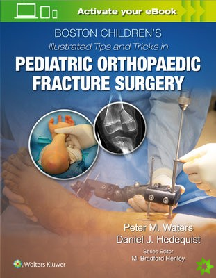 Boston Childrens Illustrated Tips and Tricks  in Pediatric Orthopaedic Fracture Surgery