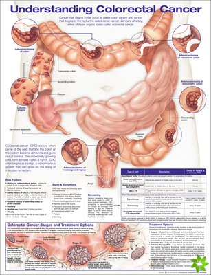 Understanding Colorectal  Cancer Anatomical Chart