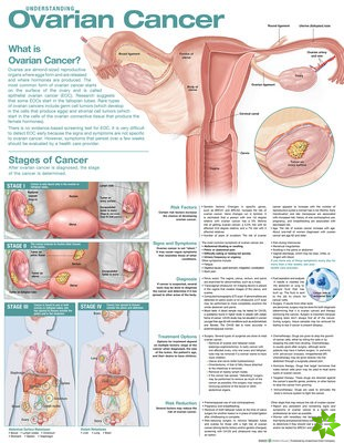 Understanding Ovarian Cancer Anatomical Chart