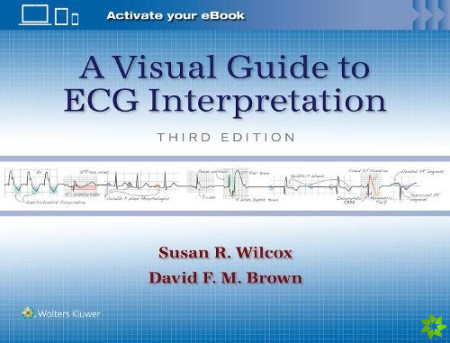 Visual Guide to ECG Interpretation: Print + eBook with Multimedia